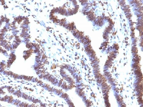 FBXO5 antibody