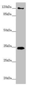 FBXO6 antibody