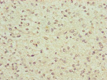 FBXO6 Antibody