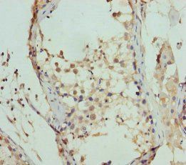 FBXO7 Antibody