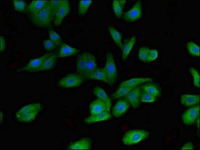 FBXO9 Antibody