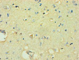 FBXW11 Antibody