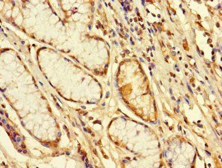 FBXW12 Antibody