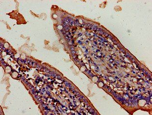 FBXW2 antibody