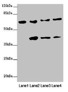 FBXW5 antibody