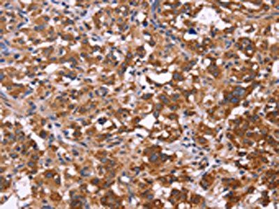 FBXW7 antibody