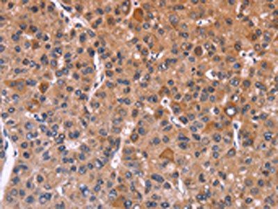FBXW7 Antibody