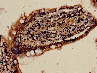 FBXW7 antibody