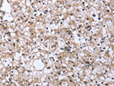 FCAR Antibody