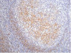 FCER2 antibody