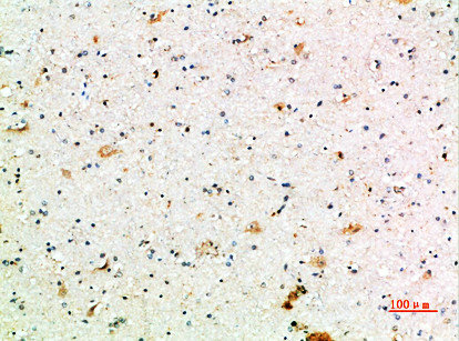 FCGR1A antibody