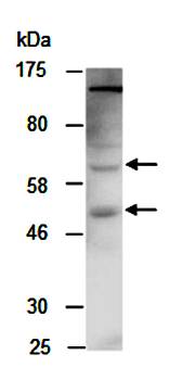 FCGR1A (C) Antibody, Rabbit Polyclonal