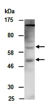 FCGR1A antibody