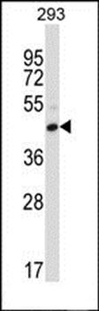 FCGR2C antibody