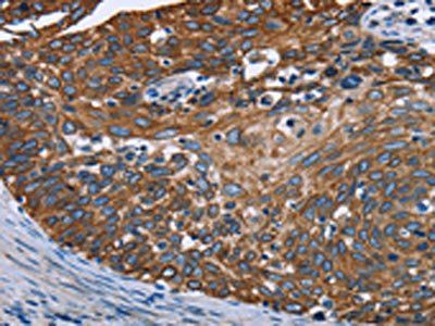 FCGR3A Antibody