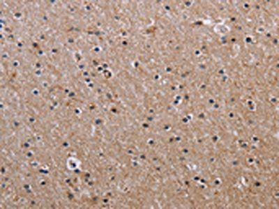 FCGR3A Antibody