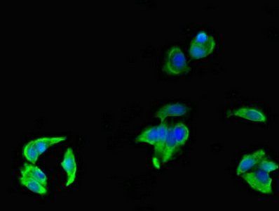 FCGR3A Antibody