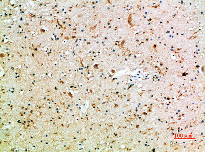 FCGR3A/FCGR3B Antibody