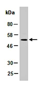 FCGR3B antibody
