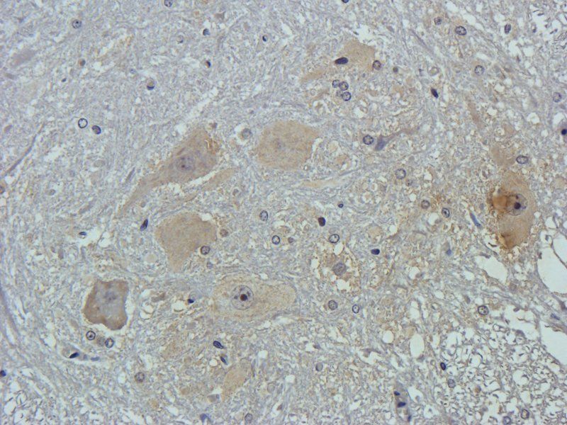 FCGRT/FcRn Rabbit Polyclonal Antibody