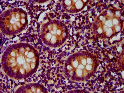 FCHO1 Antibody