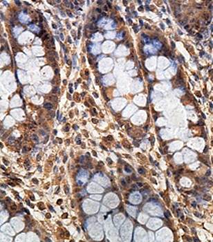 FCHO1 Rabbit Polyclonal Antibody