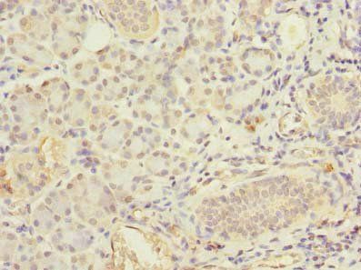 FCHSD2 Antibody