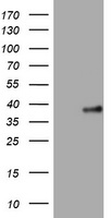 FCP1 (CTDP1) antibody