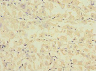 FCRL2 antibody