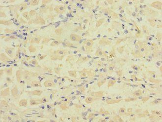FCRL2 Antibody