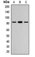 FCRL3 antibody