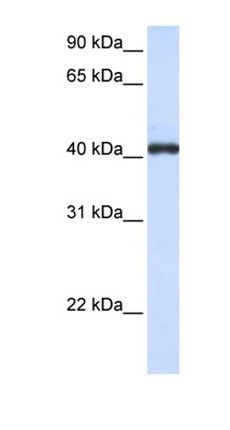 FCRLA antibody