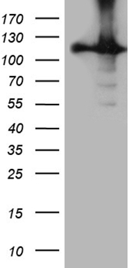FCRLB antibody