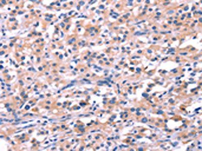 FEM1B Antibody