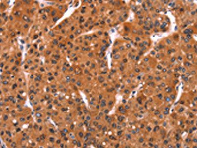 FEM1B Antibody