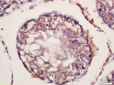 FEM 1B Rabbit Polyclonal Antibody
