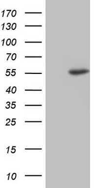 FEN1 antibody