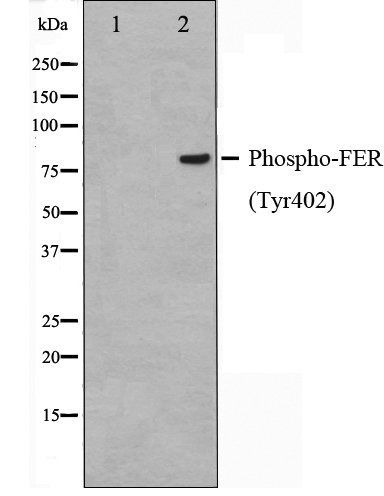 FER (Phospho-Tyr402) antibody