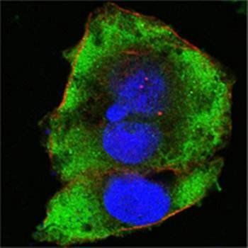 FER Antibody