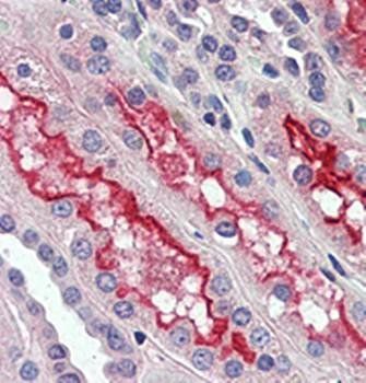 FER Antibody
