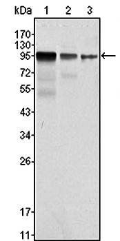 FER Antibody