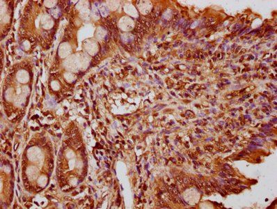 FEV Antibody