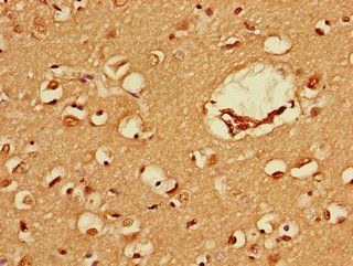 FEZ1 Antibody