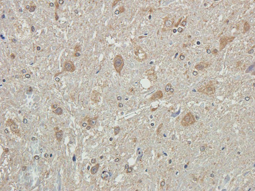 FFAR1 antibody