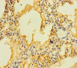 FFAR2 Antibody