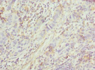 FGD5 Antibody