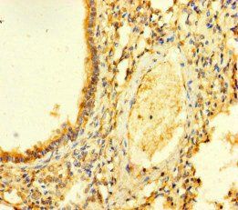 FGD5 Antibody