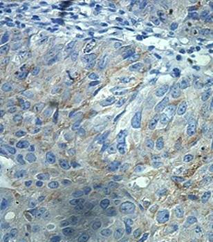 FGD5 Rabbit Polyclonal Antibody