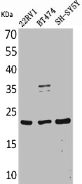 FGF12 Antibody