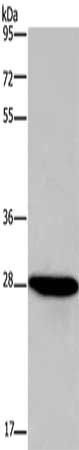 FGF17 antibody